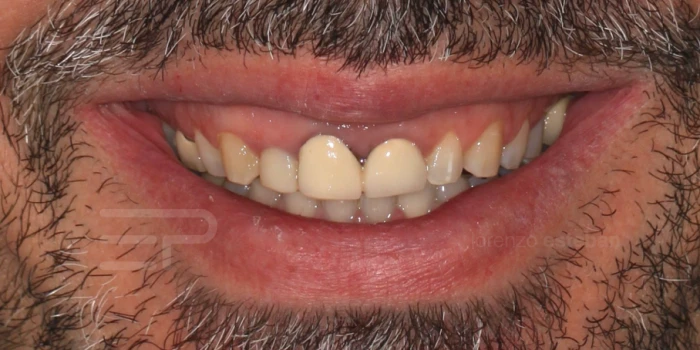 Casos Clínicos Dentales | Estética Dental